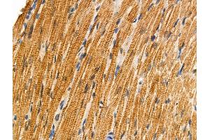 Phospho-BID (Ser78) Antibody at 1/100 staining Rat heart tissue by IHC-P.