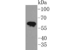 A431 lysates, probed with Cytokeratin 5 (2H5) Monoclonal Antibody  at 1:1000 overnight at 4˚C. (Cytokeratin 5 anticorps)
