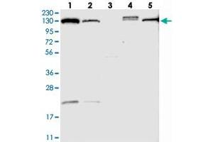 Western blot analysis of Lane 1: RT-4, Lane 2: U-251 MG, Lane 3: Human Plasma, Lane 4: Liver, Lane 5: Tonsil with TPP2 polyclonal antibody .