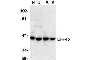 Immunocytochemical staining of DFF45 in HeLa cells with DFF45 antibody at 5μg/ml.