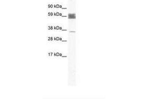 Image no. 1 for anti-Zinc Finger Protein 713 (ZNF713) (AA 118-167) antibody (ABIN202504) (ZNF713 anticorps  (AA 118-167))
