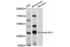 Western blot analysis of extracts of various cell lines, using NLRP11 antibody (ABIN5998353) at 1/1000 dilution. (NLRP11 anticorps)