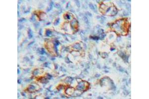 Used in DAB staining on fromalin fixed paraffin-embedded Ovary tissue (FSHR anticorps  (AA 18-113))