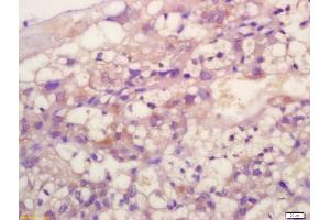 Formalin-fixed and paraffin embedded mouse placenta labeled with Anti-TIMP-2 Polyclonal Antibody, Unconjugated (ABIN1713918) at 1:200 followed by conjugation to the secondary antibody and DAB staining