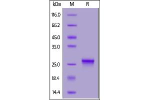 Biotinylated Human IL-17C, His,Avitag on  under reducing (R) condition.
