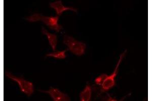 ABIN6275126 staining K562 by IF/ICC. (FOLR1 anticorps  (Internal Region))