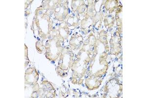 Immunohistochemistry of paraffin-embedded human stomach using AHCYL1 antibody (ABIN5975313) at dilution of 1/100 (40x lens).