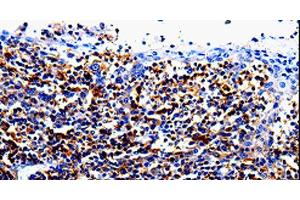 Immunohistochemistry of paraffin-embedded Human tosil tissue using IL10RA Polyclonal Antibody at dilution 1:60 (IL-10RA anticorps)
