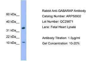 WB Suggested Anti-GABARAP  Antibody Titration: 0.