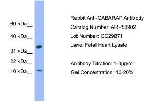 WB Suggested Anti-GABARAP  Antibody Titration: 0. (GABARAP anticorps  (C-Term))