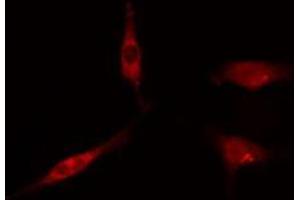 ABIN6275033 staining  Hela cells by IF/ICC. (C1QBP anticorps  (Internal Region))