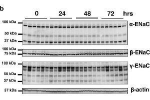 The expression of ENaC subunits after preservation in UW solution.