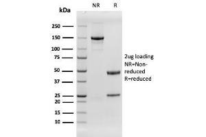 SDS-PAGE Analysis Purified EGFR Recombinant Mouse Monoclonal Antibody (rGFR/1667).