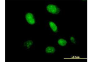 Immunofluorescence of purified MaxPab antibody to CXorf43 on HeLa cell. (HDX anticorps  (AA 1-690))