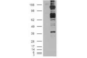 Image no. 2 for anti-Caspase Recruitment Domain Family, Member 11 (CARD11) (C-Term) antibody (ABIN374314) (CARD11 anticorps  (C-Term))