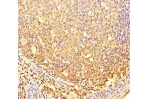 Immunohistochemistry of paraffin-embedded human tonsil tissue using ABIN7148034 at dilution of 1:100 (CBWD2 anticorps  (AA 96-395))