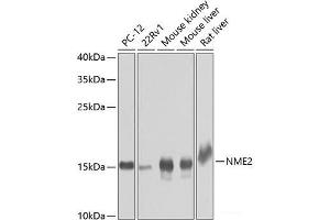 Western blot analysis of extracts of various cell lines using NME2 Polyclonal Antibody at dilution of 1:1000. (NME2 anticorps)