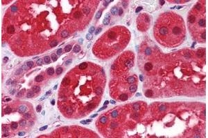 Human Kidney: Formalin-Fixed, Paraffin-Embedded (FFPE)