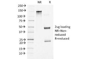 SDS-PAGE Analysis of Purified, BSA-Free Beta Catenin Antibody (clone 5H10).