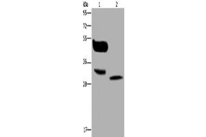 Western Blotting (WB) image for anti-Melanoma Antigen Family A, 8 (MAGEA8) antibody (ABIN2423755) (MAGEA8 anticorps)