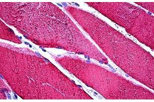 Human Skeletal Muscle: Formalin-Fixed, Paraffin-Embedded (FFPE)