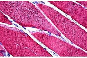 Human Skeletal Muscle: Formalin-Fixed, Paraffin-Embedded (FFPE) (TNNC1 anticorps)