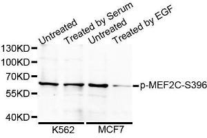 Western blot analysis of extracts from 24 hours starved 3T3 cells using Phospho-MEF2C-S396 antibody.