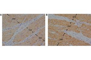 Immunohistochemical studies with an anti-FFA4 antibody on porcine lower esophageal sphincter.