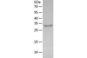 Western Blotting (WB) image for Leucine Carboxyl Methyltransferase 1 (LCMT1) (AA 1-334) protein (His-IF2DI Tag) (ABIN7123749)