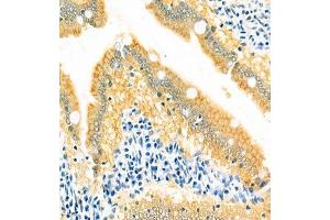 Immunohistochemistry of paraffin embedded rat small intestine using GRASP (ABIN7074140) at dilution of 1:400 (400x lens)