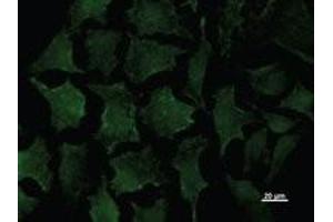 Immunostaining analysis in HeLa cells.