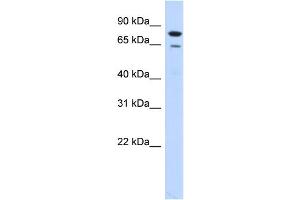 WB Suggested Anti-RMI1 Antibody Titration:  0. (RMI1 anticorps  (N-Term))
