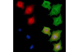 ABIN6258958 and ABIN6275208 staining  cells by IF/ICC.