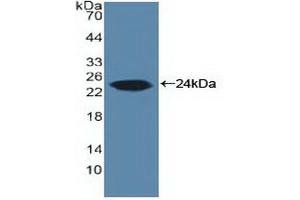 Western blot analysis of recombinant Human ARO. (Aromatase anticorps  (AA 196-373))