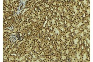 ABIN6277660 at 1/100 staining Mouse kidney tissue by IHC-P. (DCLRE1C anticorps  (C-Term))