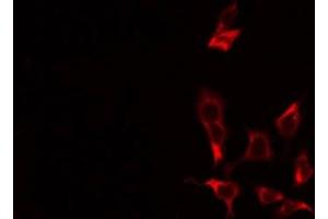 ABIN6275253 staining COLO205 by IF/ICC.