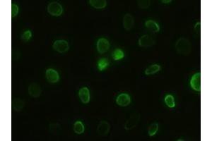 Anti-GSC mouse monoclonal antibody (ABIN2452379) immunofluorescent staining of HeLa cells transiently transfected by pCMV6-ENTRY GSC (RC209586) (GSC anticorps  (AA 107-257))