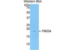 Western Blotting (WB) image for anti-Collagen, Type VIII, alpha 1 (COL8A1) (AA 590-744) antibody (ABIN1175571) (COL8A1 anticorps  (AA 590-744))