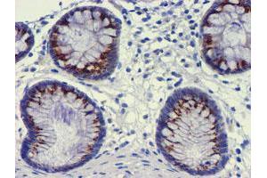 Immunohistochemistry (IHC) image for anti-Golgi Membrane Protein 1 (GOLM1) antibody (ABIN1498494) (GOLM1 anticorps)