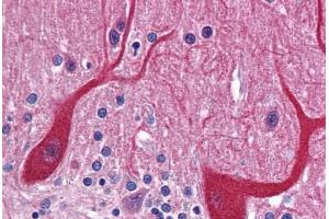 Human Brain, Cerebellum: Formalin-Fixed, Paraffin-Embedded (FFPE) (PKDCC anticorps  (Internal Region))