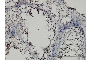 Immunoperoxidase of monoclonal antibody to SMAD2 on formalin-fixed paraffin-embedded human testis.