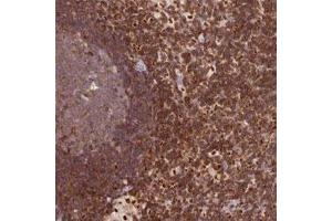 Immunohistochemical staining of human lymph node with DENND1C polyclonal antibody  shows strong cytoplasmic positivity in non-germinal center cells at 1:200-1:500 dilution. (DENND1C anticorps)