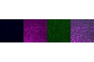 Immunohistochemistry (IHC) image for anti-Insulin-Like Growth Factor Binding Protein 6 (IGFBP6) antibody (ABIN7456037)