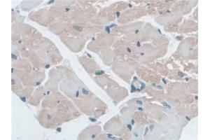 Detection of NLRP3 in Mouse Heart Tissue using Polyclonal Antibody to NLR Family, Pyrin Domain Containing Protein 3 (NLRP3)