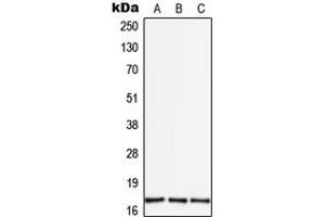 Western blot analysis of TGF alpha expression in THP1 (A), mouse brain (B), rat brain (C) whole cell lysates. (TGFA anticorps  (Center))