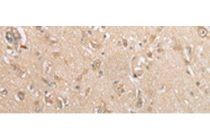 Immunohistochemistry of paraffin-embedded Human brain tissue using GCLC Polyclonal Antibody at dilution of 1:35(x200) (GCLC anticorps)