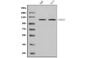 Western blot analysis of TRPA1/TSA using anti-TRPA1/TSA antibody (ABIN7601489).