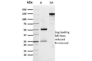 SDS-PAGE Analysis Purified Cathepsin D Mouse Monoclonal Antibody (CTSD/3276). (Cathepsin D anticorps  (AA 104-250))