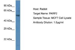 Host:  Rabbit  Target Name:  P Sample Type:  MCF7 Whole Cell lysates  Antibody Dilution:  1.