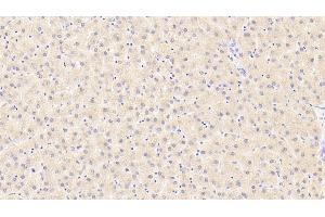 Detection of LIPC in Human Liver Tissue using Polyclonal Antibody to Lipase, Hepatic (LIPC)